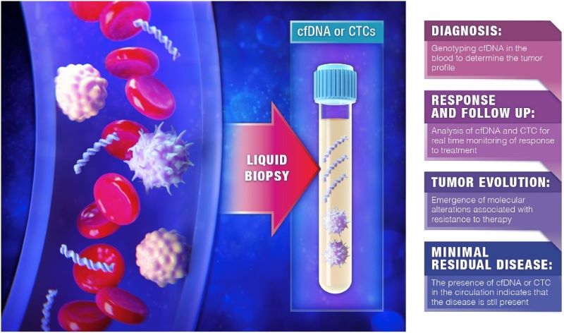 Liquid Biopsies used for Cancer Diagnosis and Screening